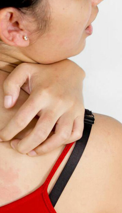 Here are a few common causes of itchy skin