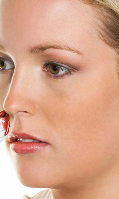 Here are the causes behind nose bleeding