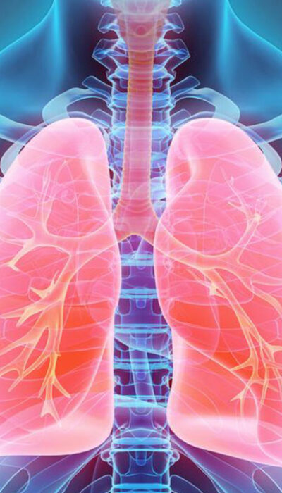 Here is a quick look at the common symptoms and treatments of lung cancer