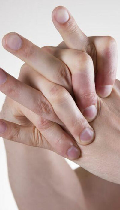 Here&#8217;s what you need to know about rheumatoid arthritis and lupus