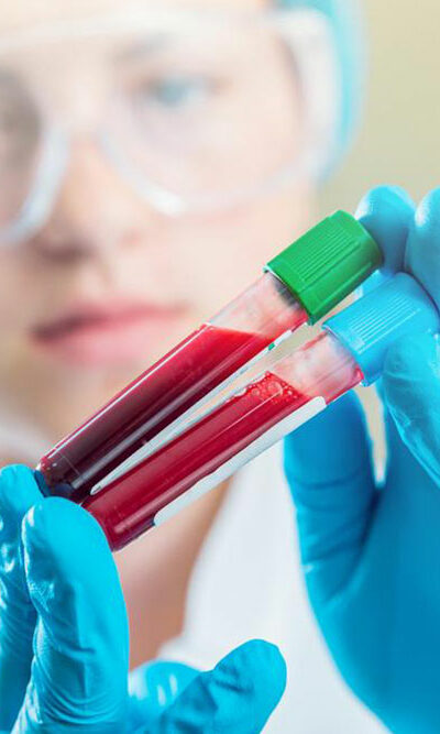 Here&#8217;s why maintaining normal creatinine levels is imperative