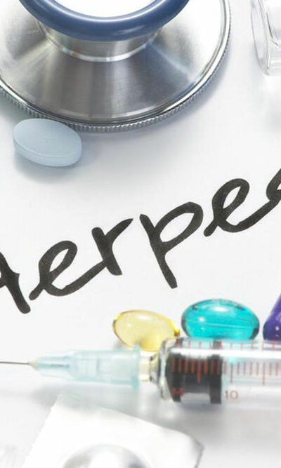 Herpes: Things one should be aware of