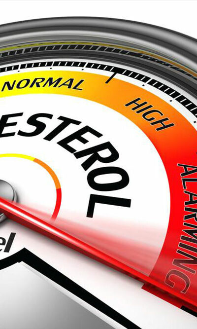 High Cholesterol: Causes and prevention