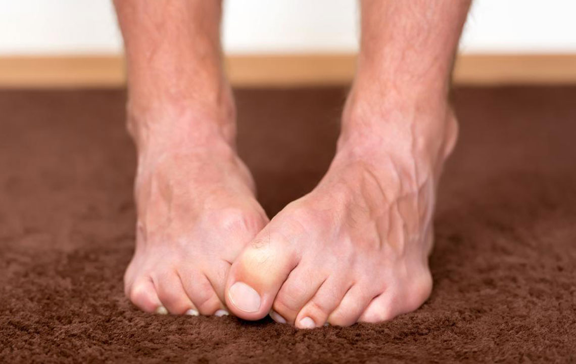 Important symptoms of neuropathy that should not be ignored