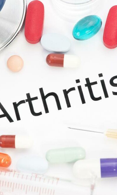 Introduction and Pathology of Osteoarthritis