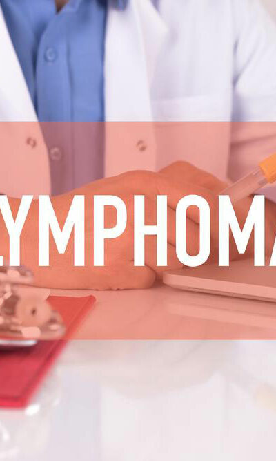 Non Hodgkin Lymphoma treatment &#8211; Symptoms, causes and more explained