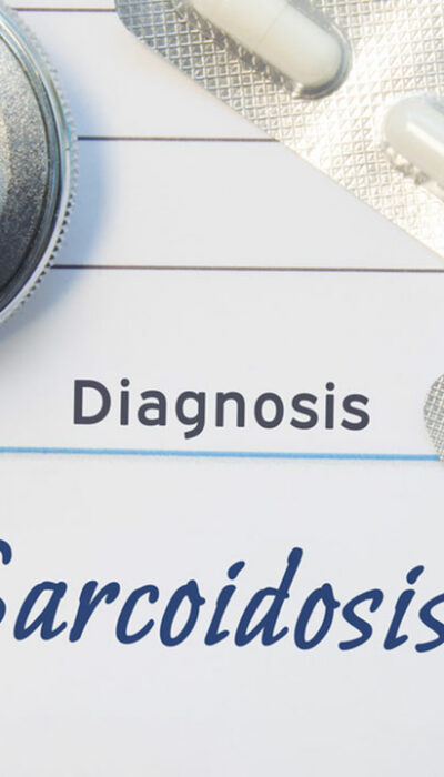 Sarcoidosis risk factors you should know about