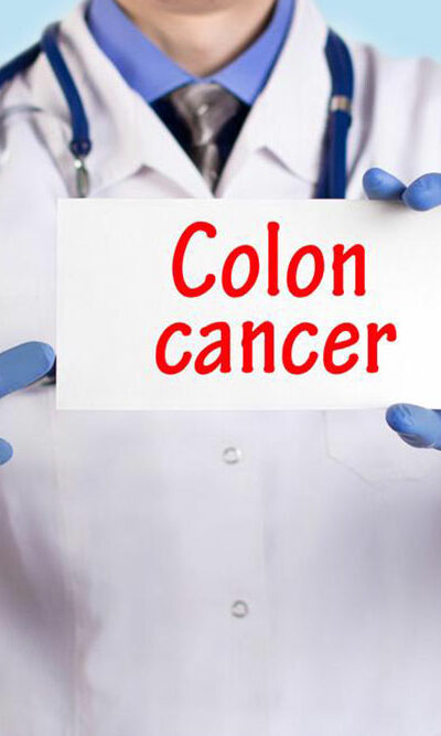 Signs and symptoms of colon cancer