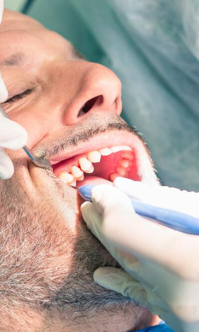 Simple yet effective ways to prevent and remove dental plaque