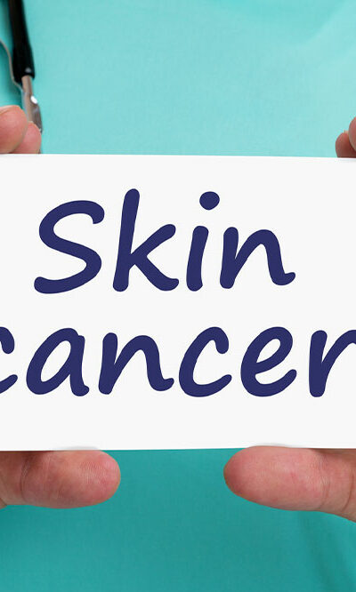 Skin Cancer &#8211; Types, Stages, and More