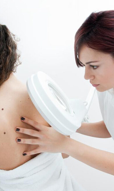 Stage four melanoma, symptoms and treatment