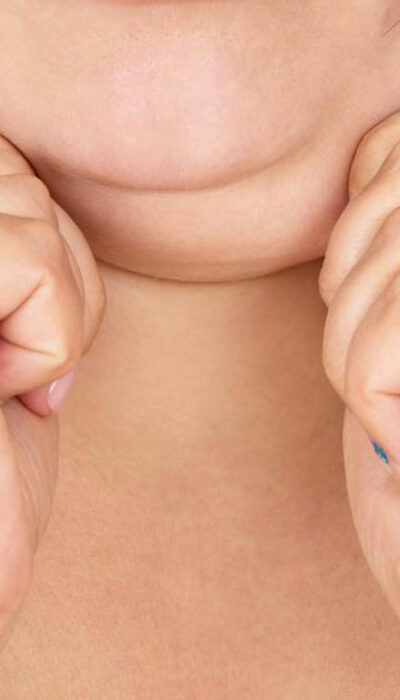 Struggling with a double chin? Here&#8217;s how you can get rid of it