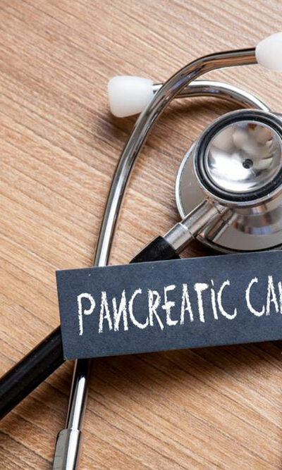 Pancreatic cancer, symptoms and treatment