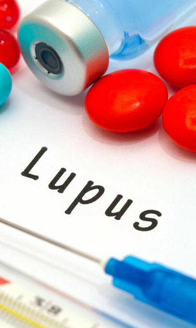 Remedies for Lupus