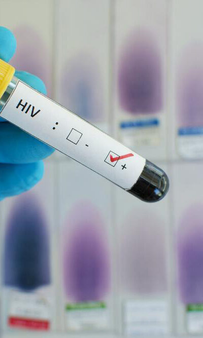 Ways to get diagnosed for HIV