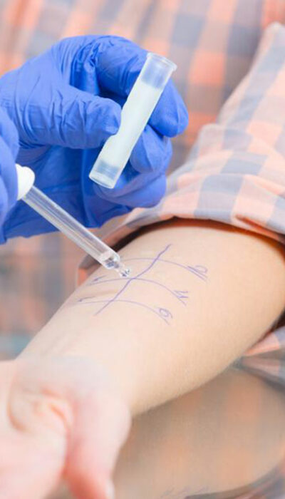 Why are A1C tests important for diabetes treatment?