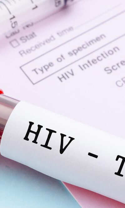 What are the early signs and symptoms of HIV infection?