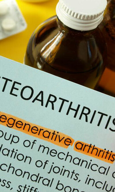 What are the treatment options for managing osteoarthritis