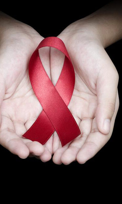 Top five causes of HIV