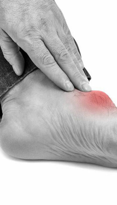 Top triggers for gout foot pain