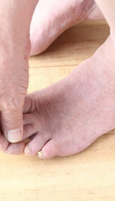 Taking a look at causes of foot pain