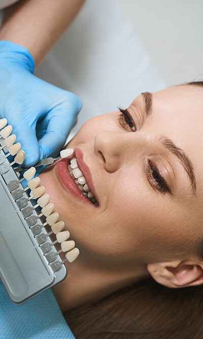 Things to know before opting for dental veneers