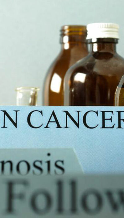 Things you need to know about colon cancer