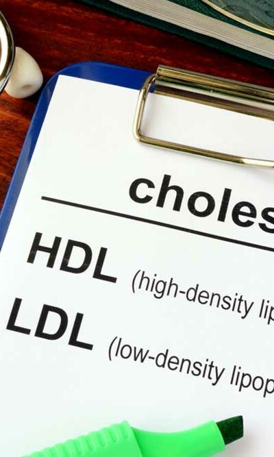 Tips to Lower Cholesterol Levels Naturally