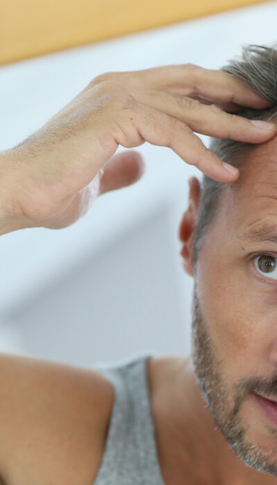 Treatment Options for Hair Loss