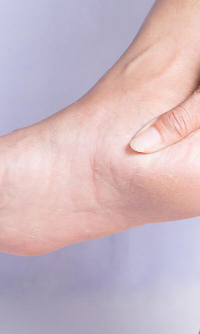 Treatment and preventive measures for heel pain