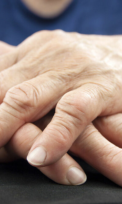 Treatment options and medications for managing rheumatoid arthritis