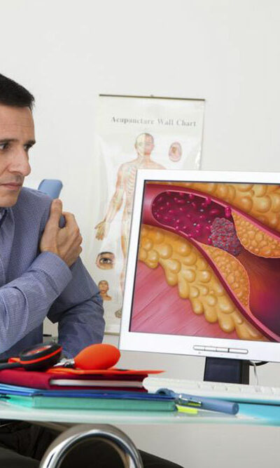 Types of Thrombosis