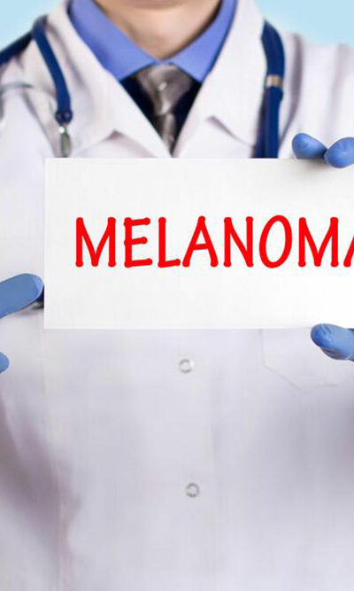 Understanding metastatic malignant melanoma