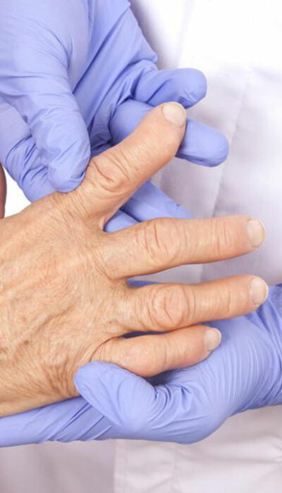 Understanding the various types of arthritis