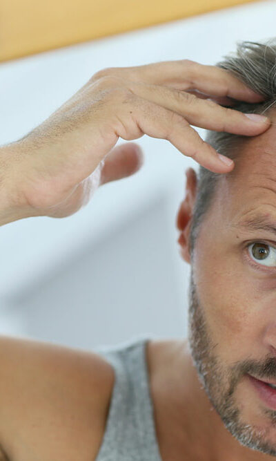 10 Effective Home Remedies to Stop Hair loss