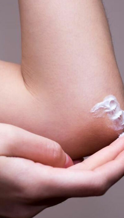 10 Popular Products to Get Relief from Eczema