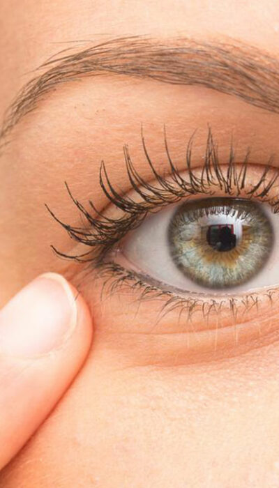 10 Tips to Remove Under-Eye Bags