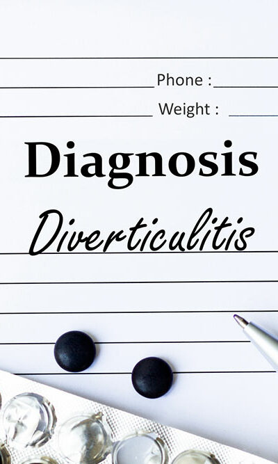 11 Foods that Trigger Diverticulitis