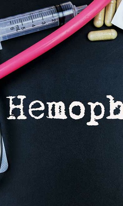 7 Common Ways to Treat Hemophilia