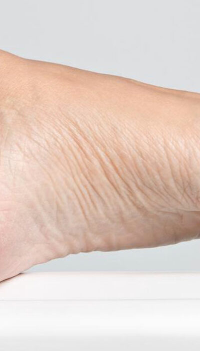 7 Useful Remedies for Foot Nerve Pain