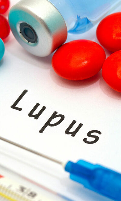 7 common symptoms of lupus