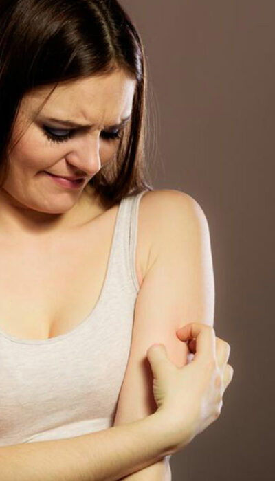 4 Types of Skin Rashes You Should Know Of