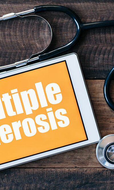 5 common treatments for multiple sclerosis