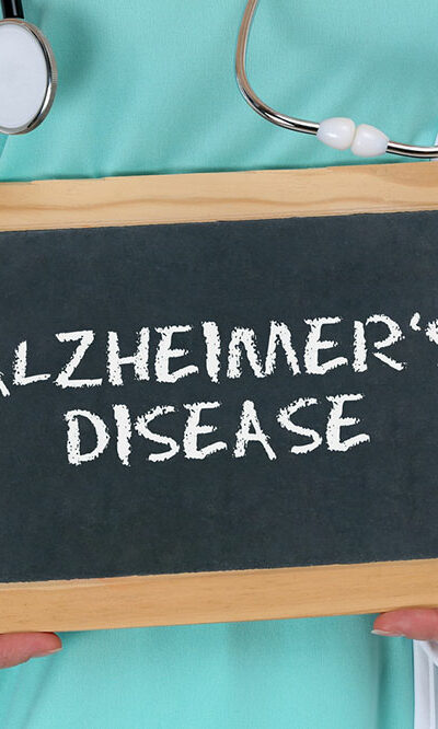 5 things to know about Alzheimer&#8217;s disease