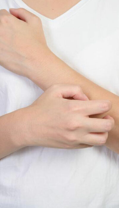 6 Effective Creams to Be Used for Eczema