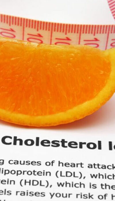 6 Self-Management Tips for High Cholesterol Treatment