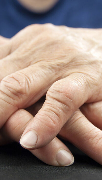 6 Ways to Manage the Symptoms of Arthritis