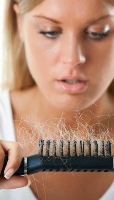 8 Common Causes of Hair Loss in Women and Their Treatments