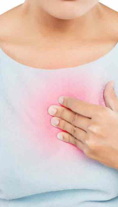 8 Effective Home Remedies for Heartburn