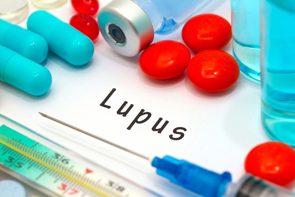 9 Early Signs and Symptoms of Lupus